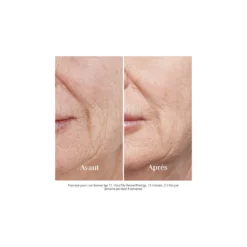 Silk'N - FaceTite Revive - Visage - Appareil anti-âge – vue 3