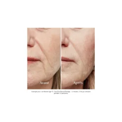 Silk'N - FaceTite Revive - Visage - Appareil anti-âge – vue 4