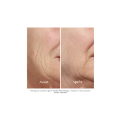 Silk'N - FaceTite Revive - Visage - Appareil anti-âge – vue 5