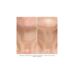 Silk'N - FaceTite Revive - Visage - Appareil anti-âge – vue 6